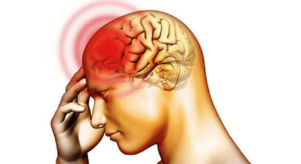 Meningitis