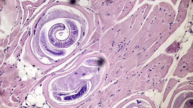 Triquinosis: qué es, cuáles son sus síntomas y cómo se transmite