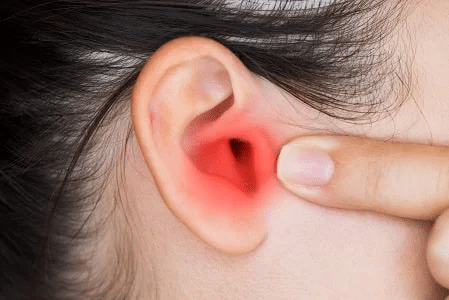 otitis externa verano agua