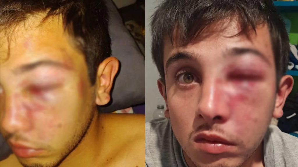 Córdoba golpearon a un joven patota