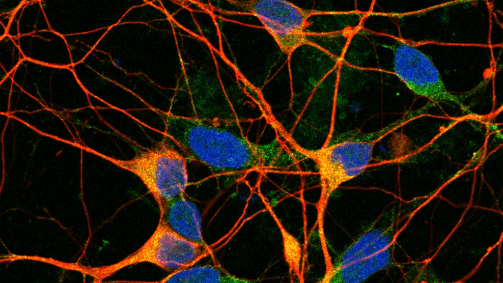 conicet reciben importante subsidio internacional Alzheimer enfermedad