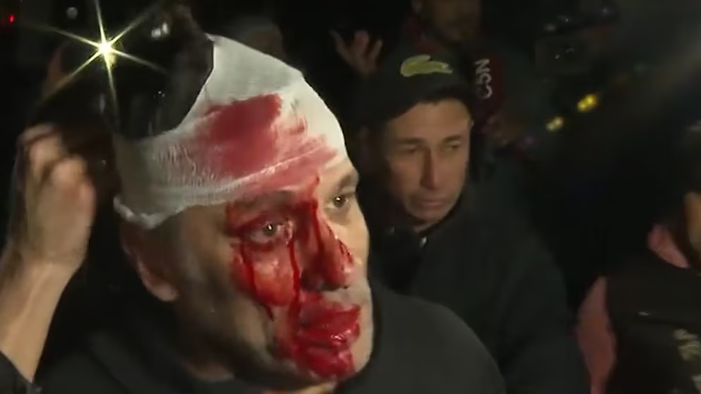 Gravísimo: golpearon y le partieron la cara a un periodista de América TV en el acto de Javier Milei en Moreno