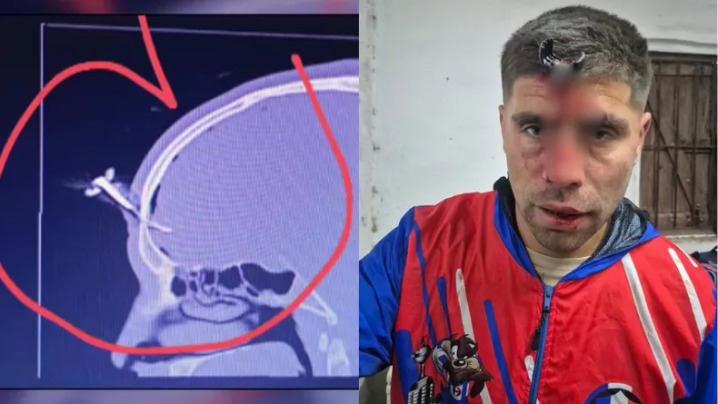 berazategui llave cabeza partido fútbol