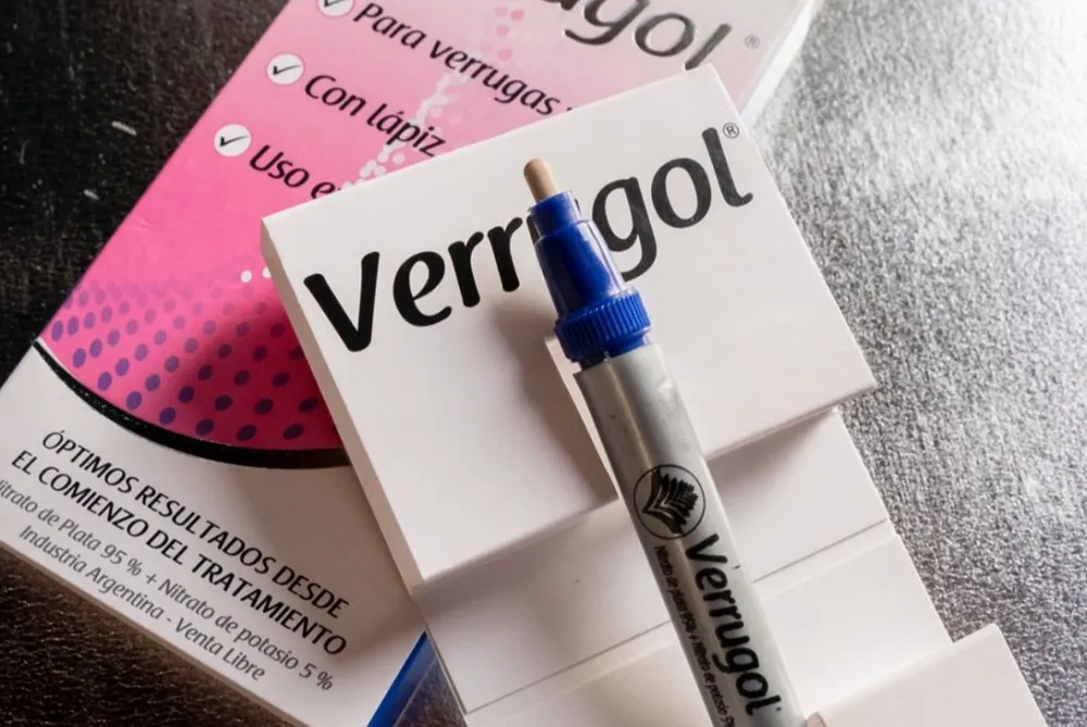 La ANMAT prohibió un medicamento para tratar callos y verrugas