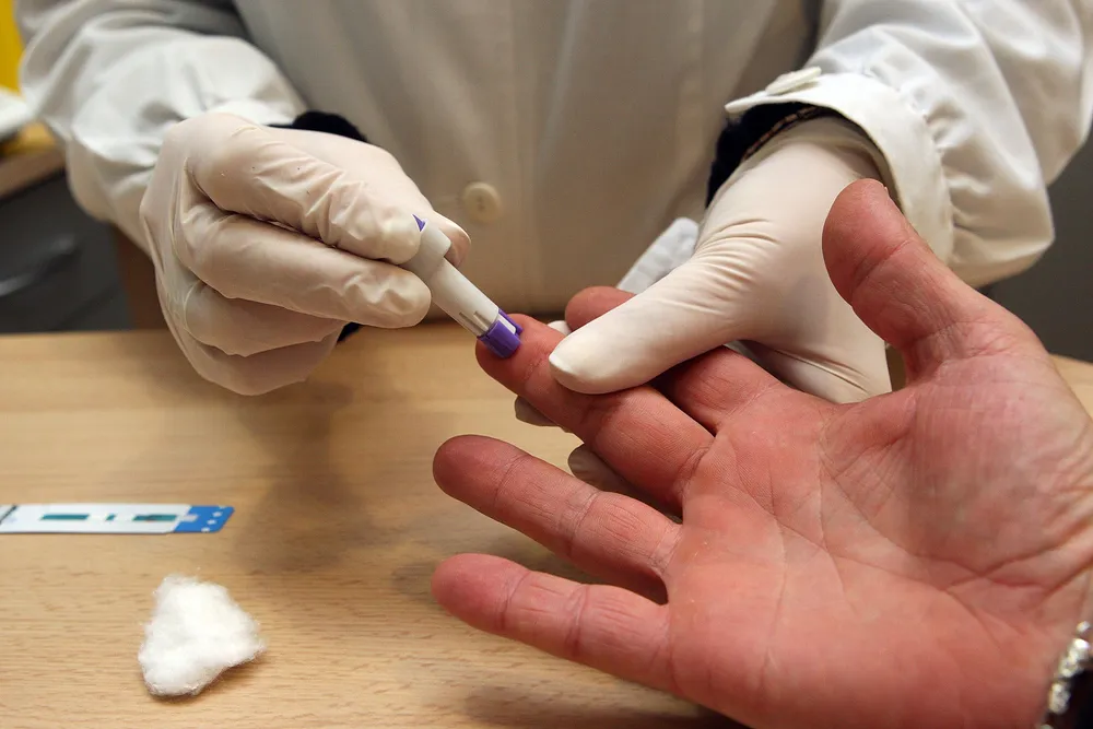 Prueba de VIH: tres de cada diez nuevos diagnósticos fueron en personas que se testeaban por primera vez