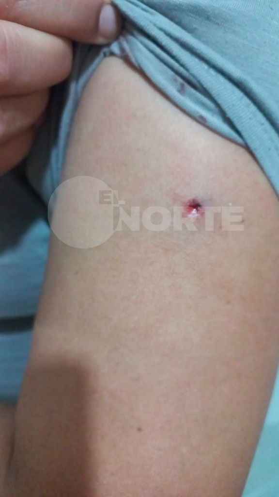 "Dame el celular": atacaron a tres mujeres para robarles en el viaducto de Nación y una terminó con una herida en el brazo
